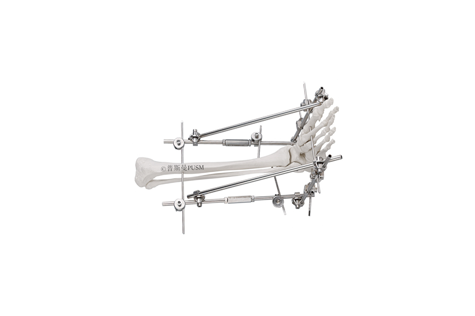 SPUSM-C2401 Ankle External Fixator