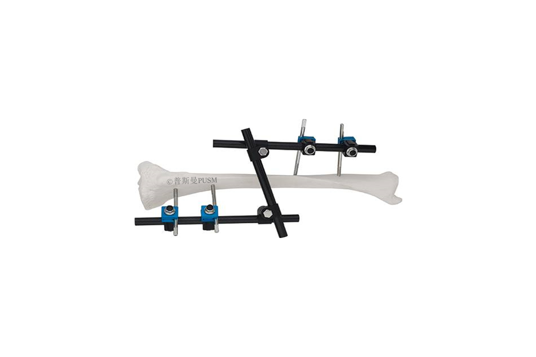 SPUSM-A13 Tibial & Femur External Fixator