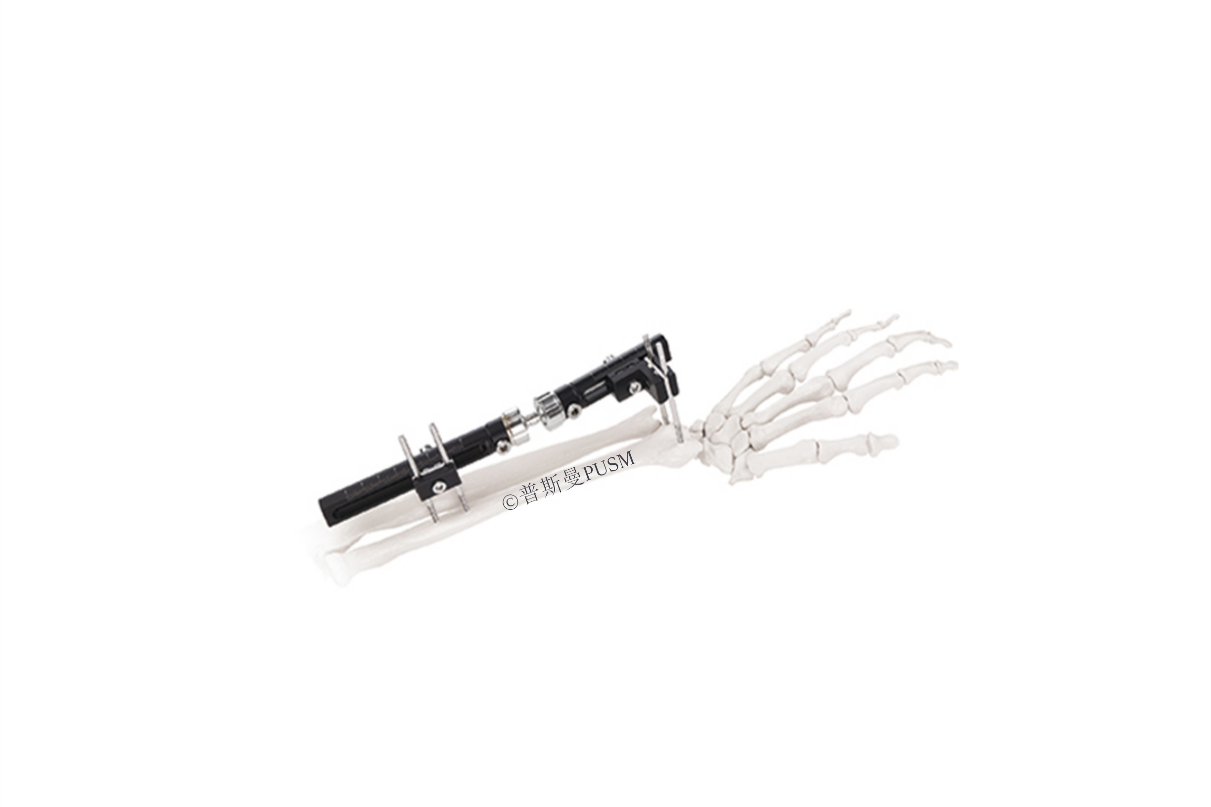 SPUSM-O0201 Wrist Joints External Fixator Type A