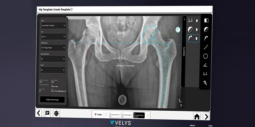 FLUORO NAV CUTS THA OR TIME AND READMISSION: NEW S