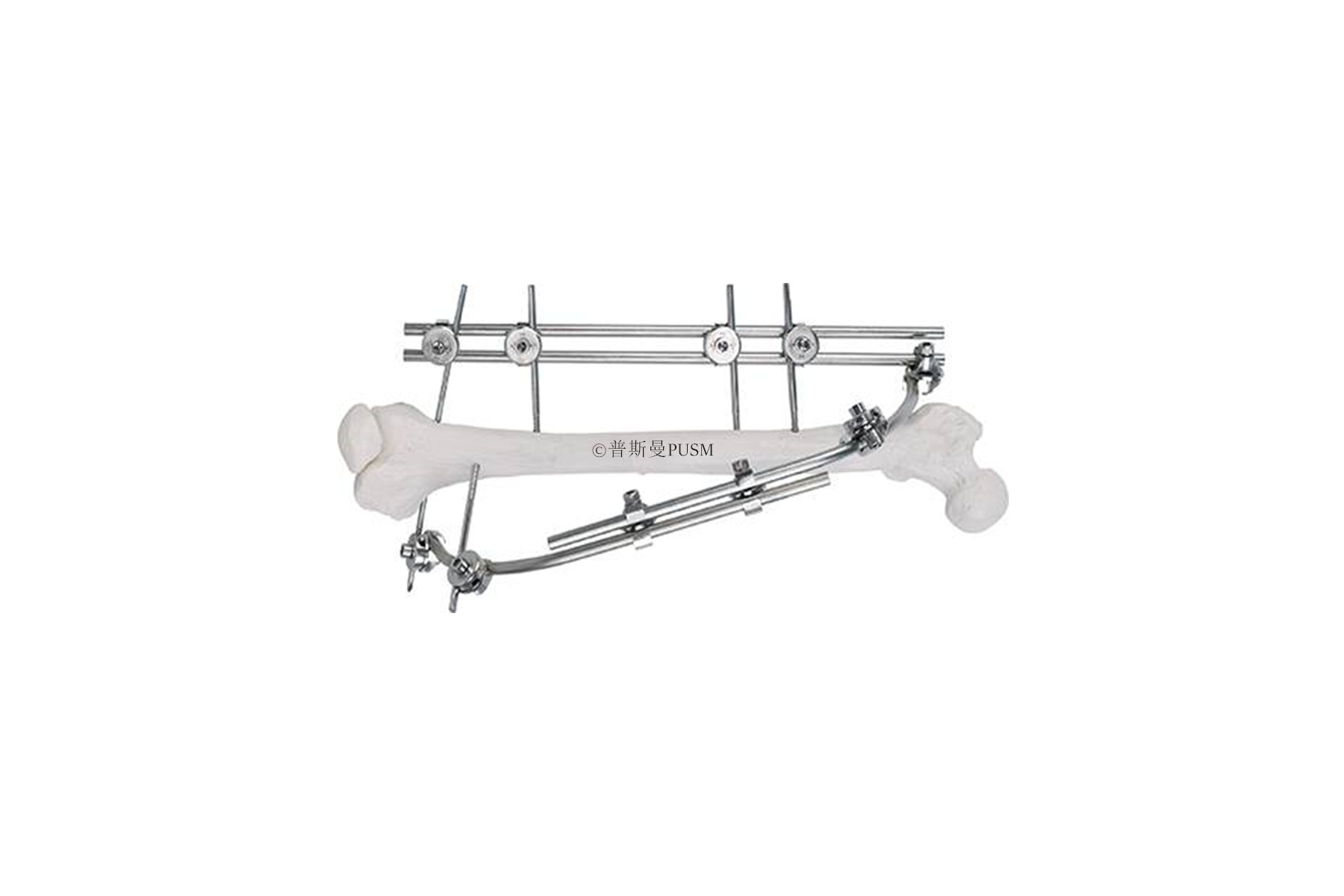 SPUSM-C2301 Femoral External Fixator