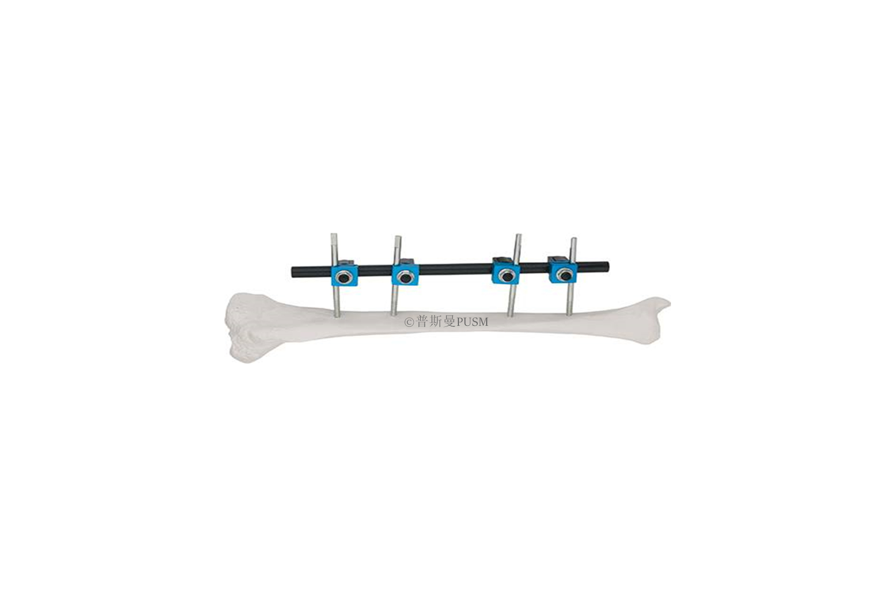 SPUSM-A14 Tibial External Fixator