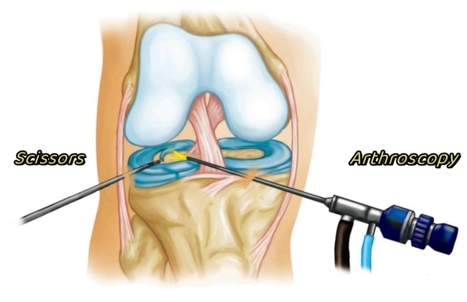 Traditional Orthopedic and Arthroscopic Surgery