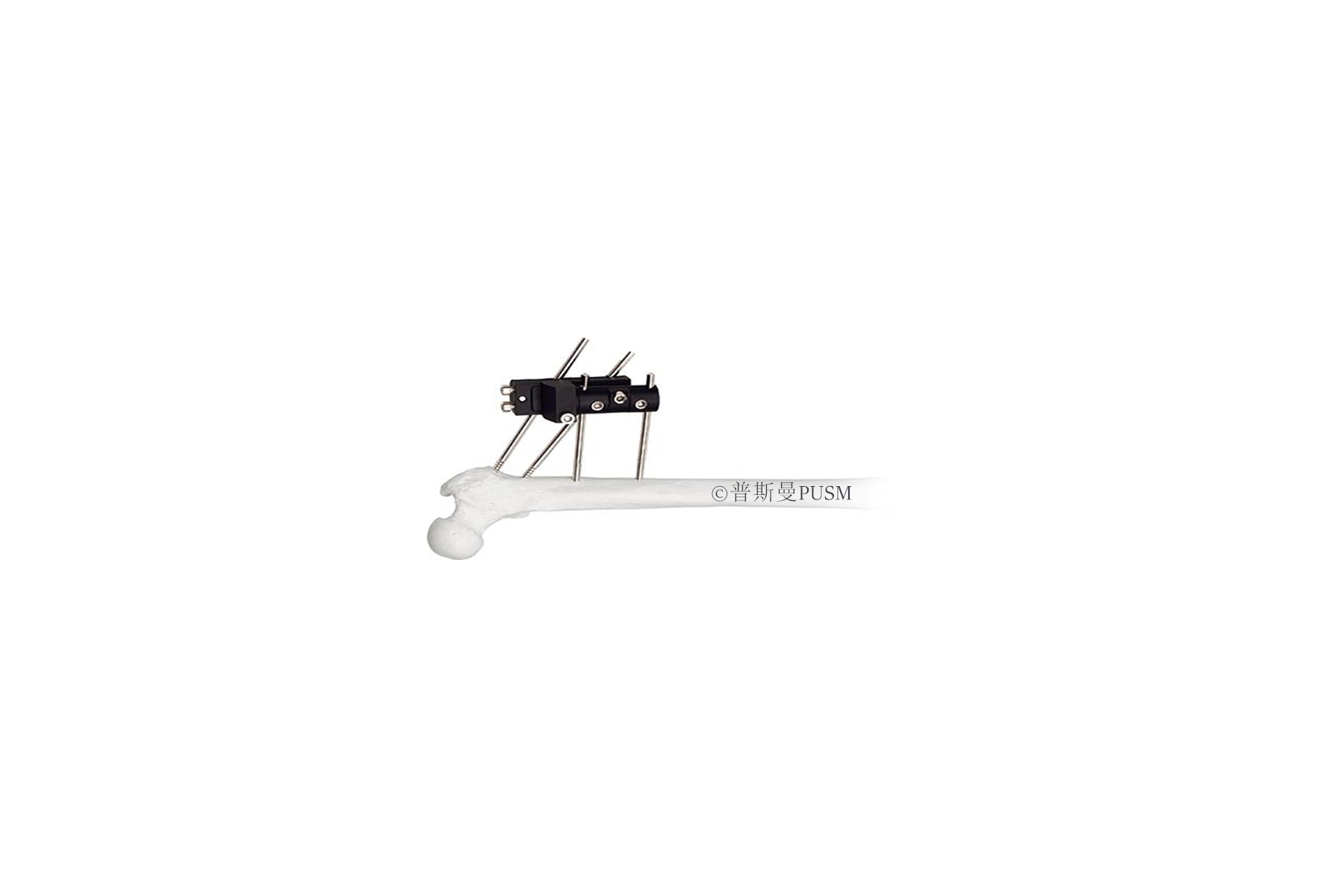 SPUSM-O0701 Hip Joint Traction External Fixator