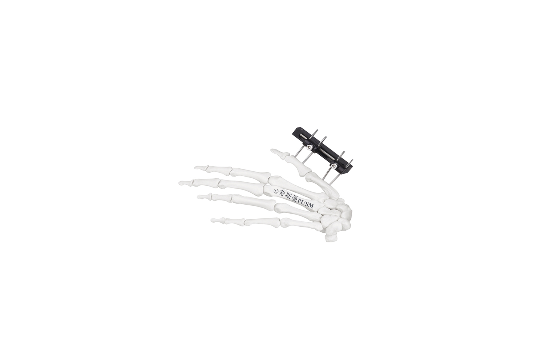 SPUSM-O0106 Mini Fragment External Fixator Type F