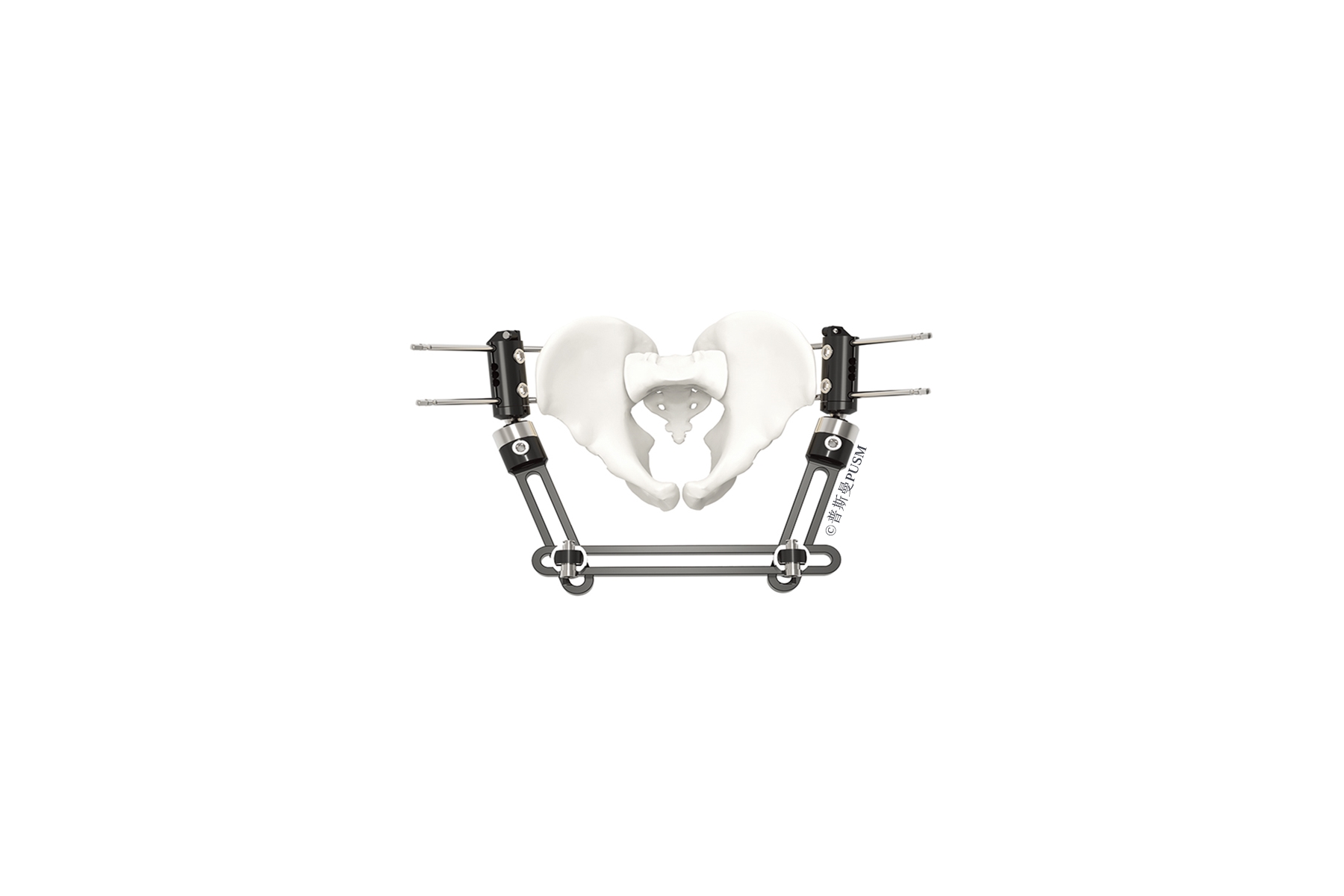 SPUSM-O1001 Pelvic Fragment External Fixator Type A