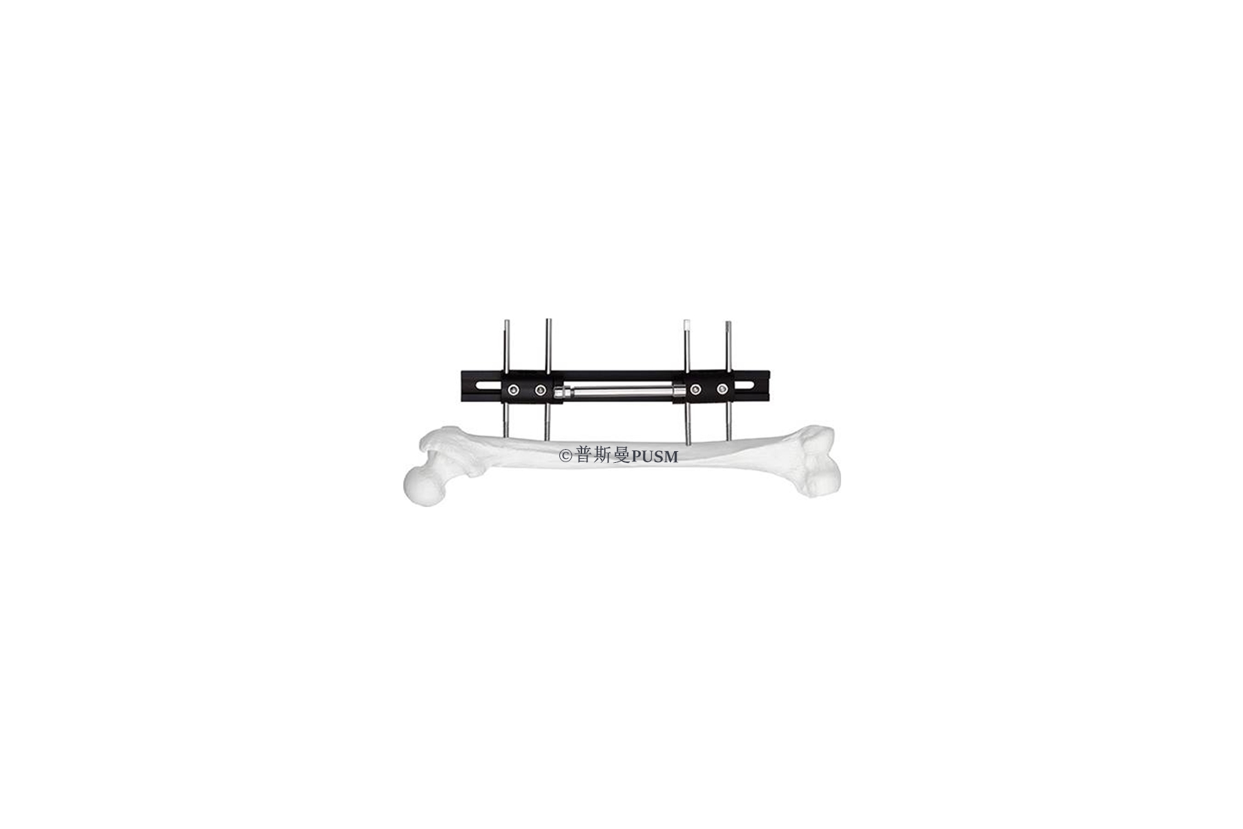 SPUSM-O1105 Bone Lengthening External Fixator Type 