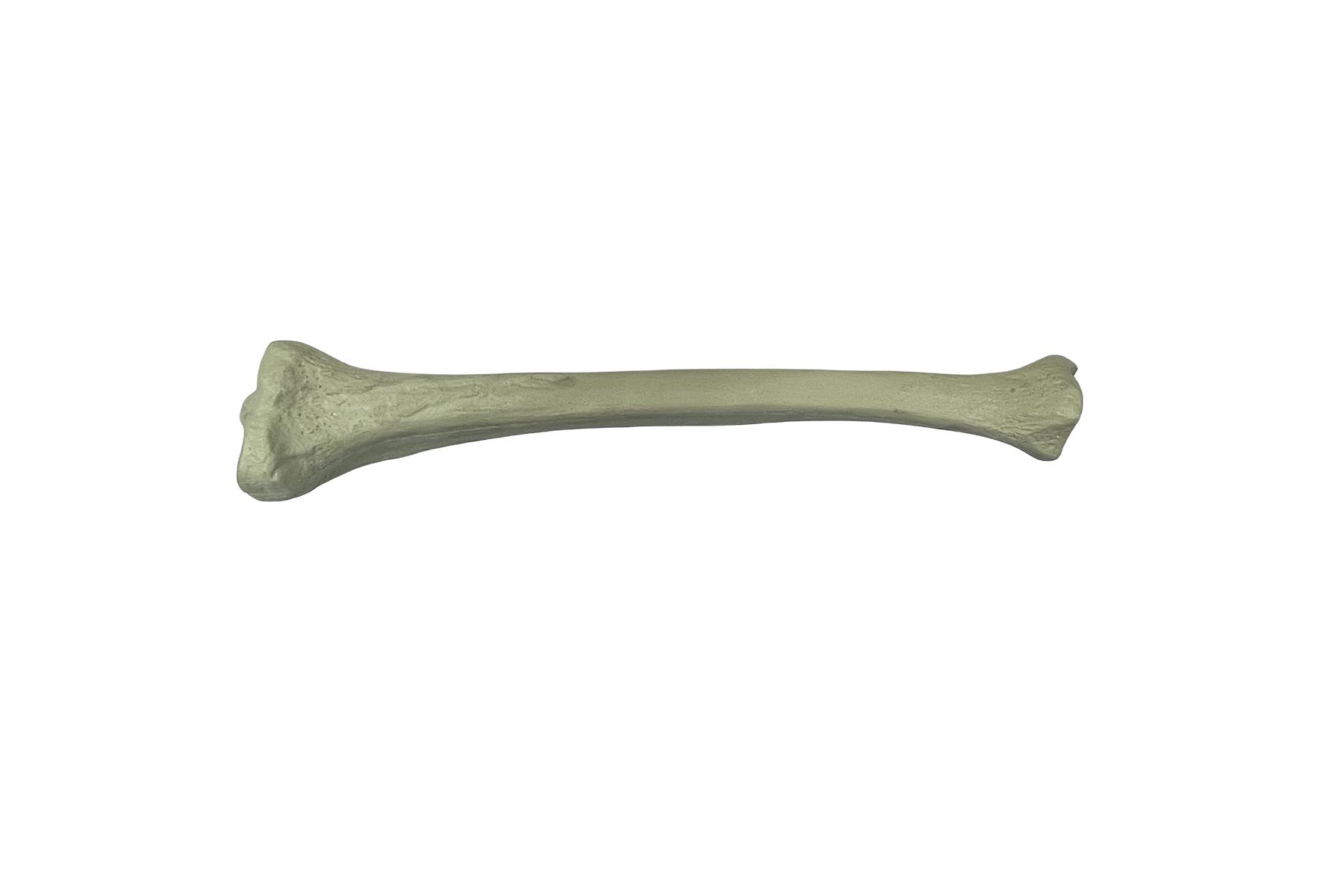 SPUSM Tibia Exercise Bone Model (Solid Core)