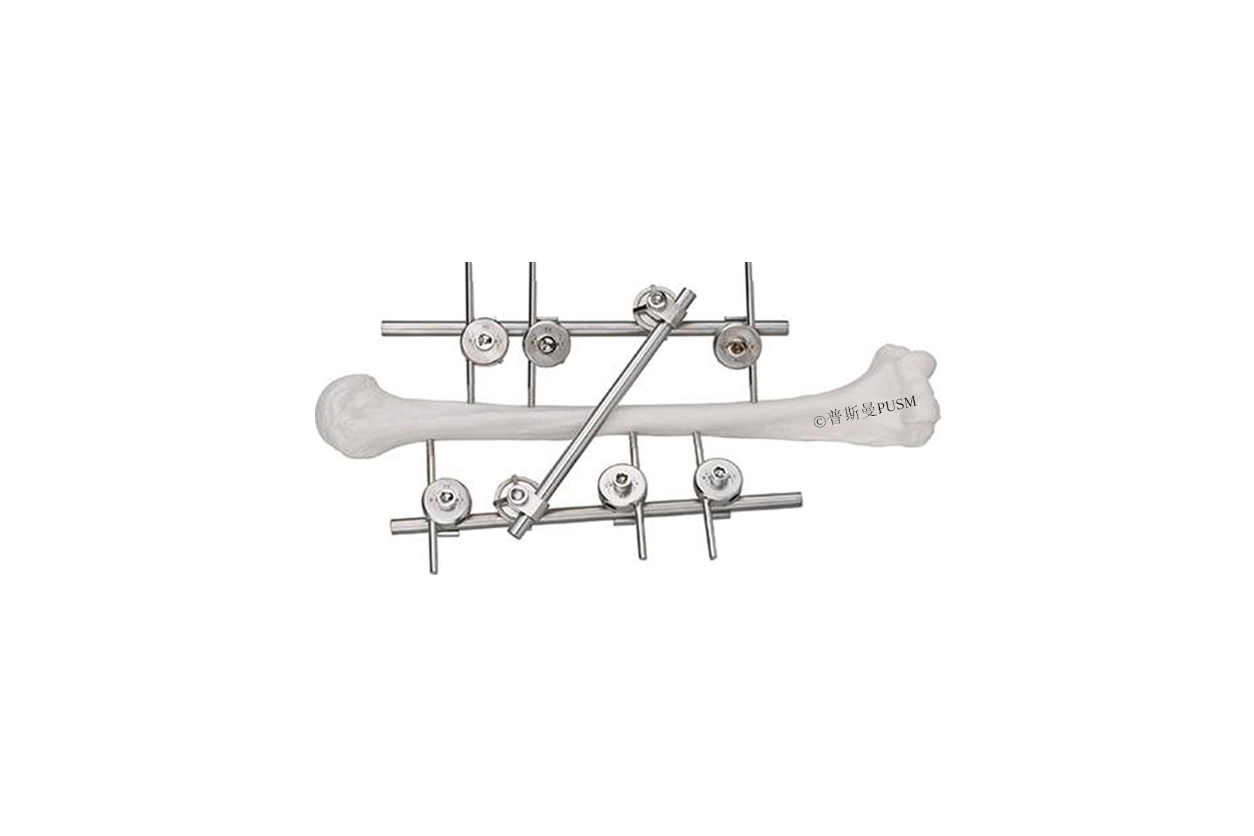 SPUSM-C2101 Humeral External Fixator