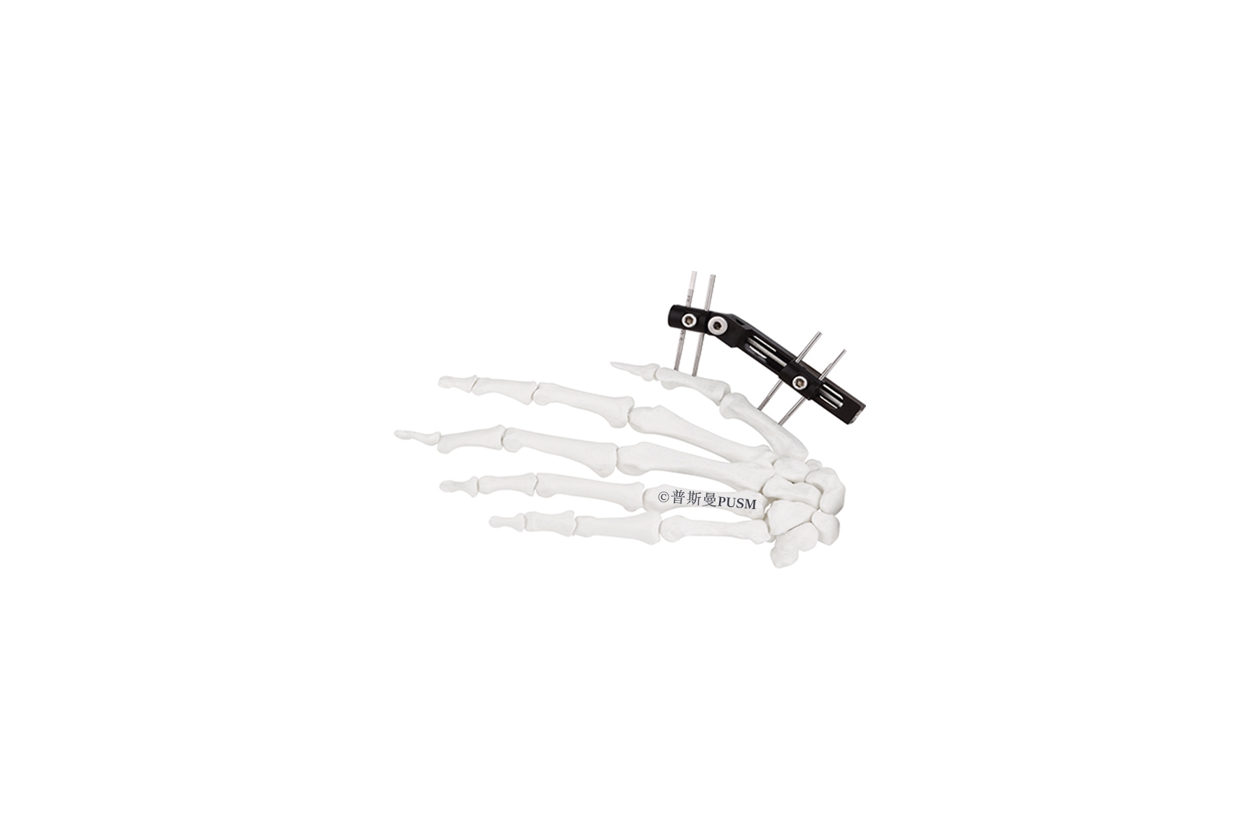 SPUSM-O0107 Mini Fragment External Fixator Type G