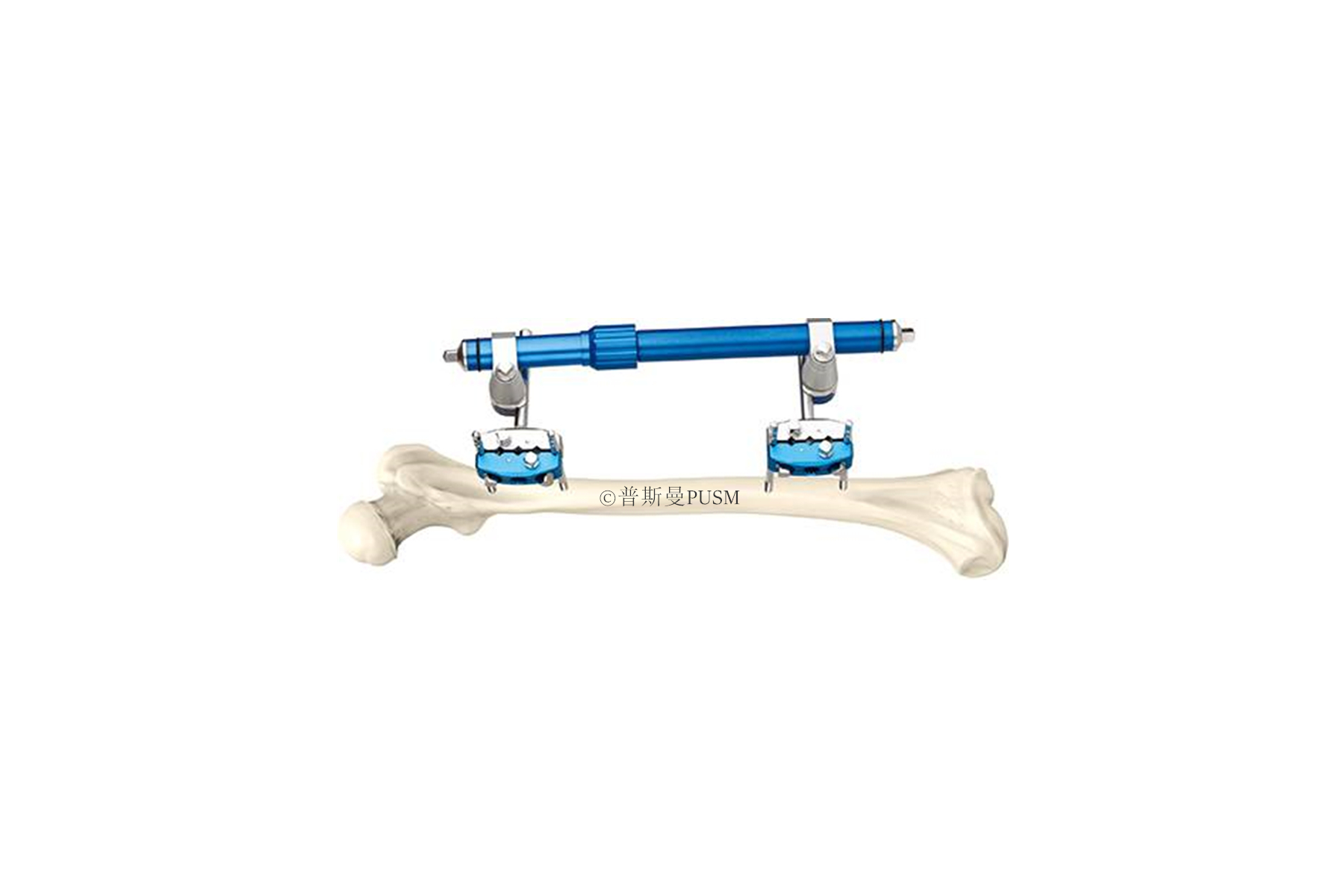 SPUSM-H20 Femoral External Fixator