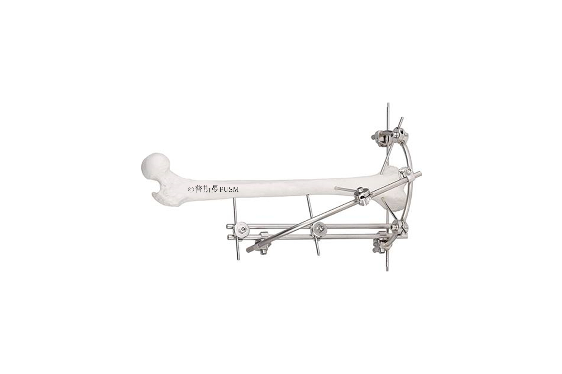 SPUSM-C2201 Femoral Condylar External Fixator