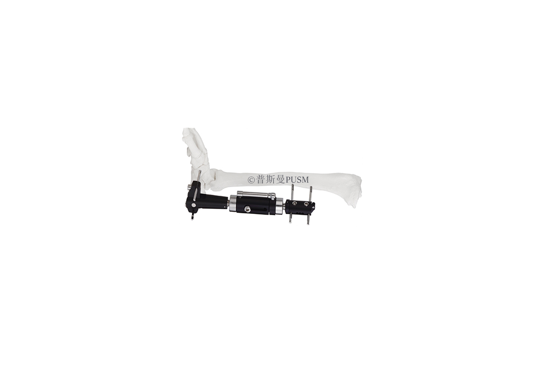 SPUSM-O0501 Ankle Joint Fragment External Fixator