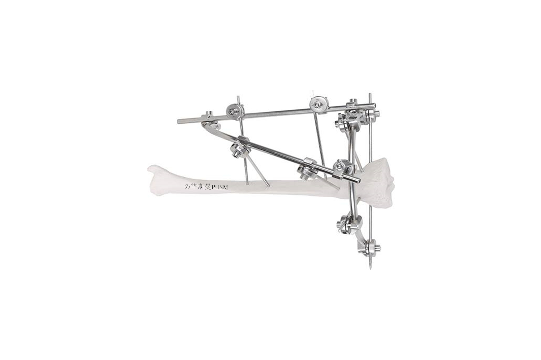 SPUSM-C2501 Proximal Tibial External Fixator